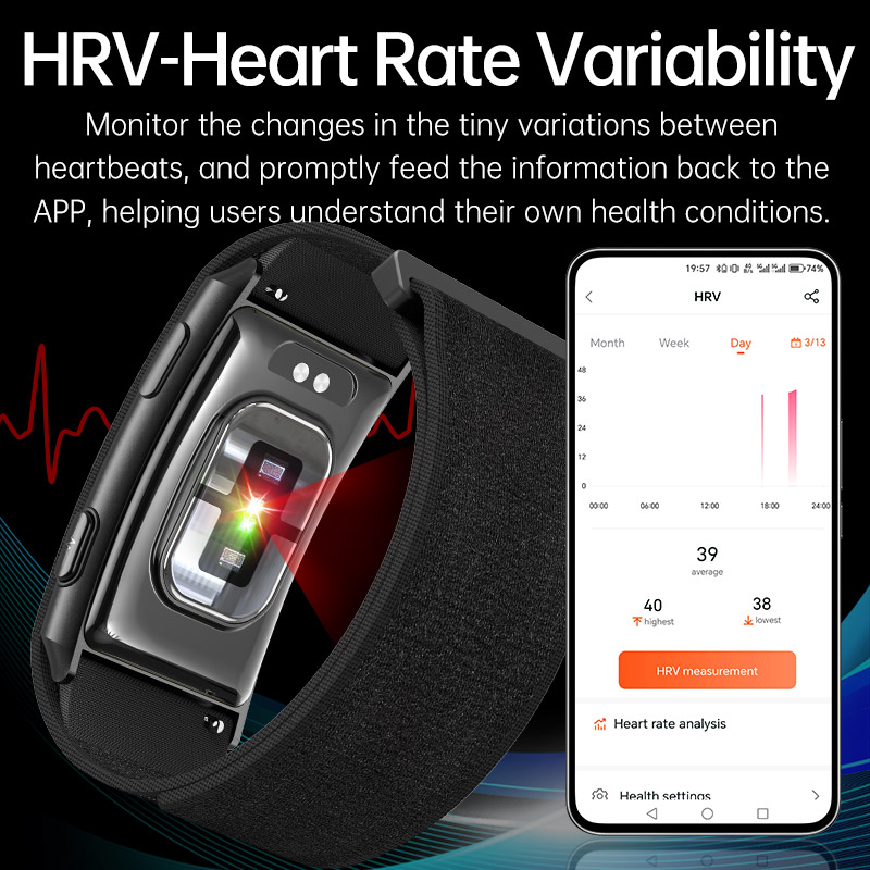 VWAR Loop X ECG Smart Bracelet – обзор и цена Xbody Health & Wellness Functional Integrative Medicine Office & Medical Spa Photos