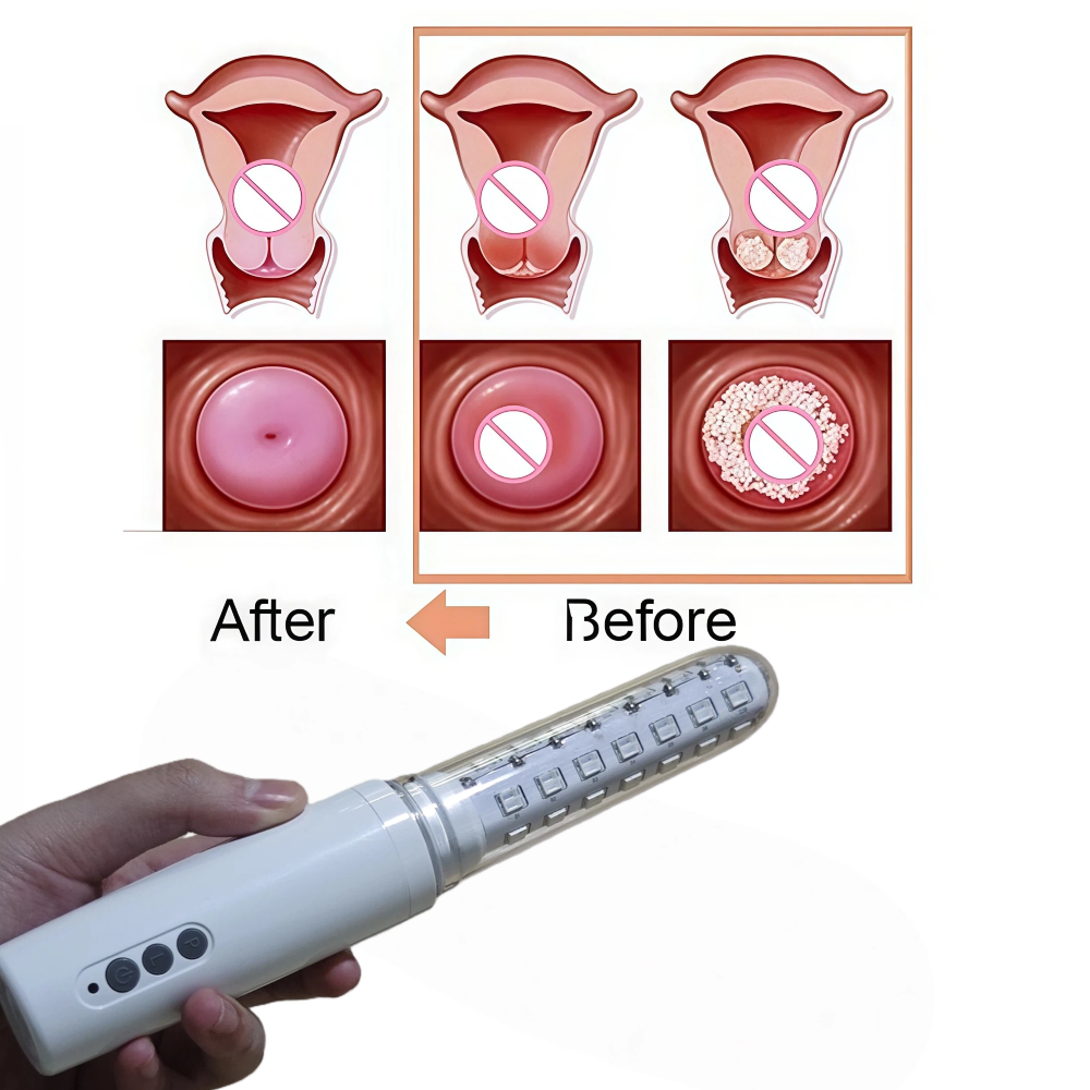 650nm LLLT Cold Laser Wand, Wo – обзор и цена Health Wellness Home Care